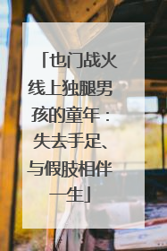 也门战火线上独腿男孩的童年：失去手足、与假肢相伴一生